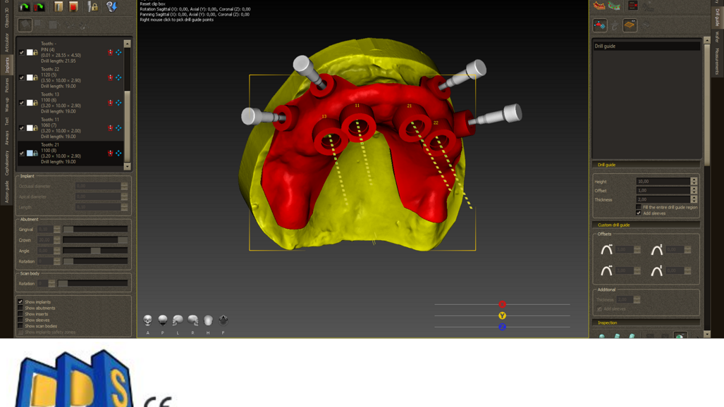 Polorto – DDS-Pro Software