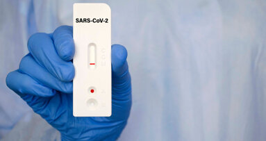 TestV: So dürfen Zahnärzte testen
