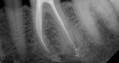 Using hand files to their full capabilities: A new look at an old yet emerging technology