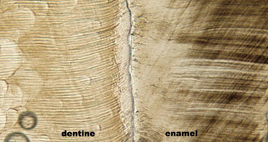 Molars provide insight into evolution of apes, humans