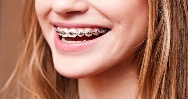 Orthodontist ‘beste baan van 2016’ in VS