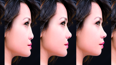 Smile analysis and photoshop smile design technique