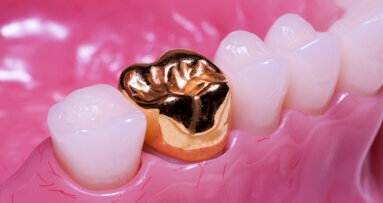 Dental entrepreneurs: Should you start your own DSO?