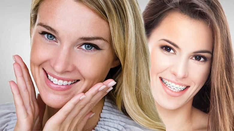 Иновативната технология Fastbraces ще бъде представена в София