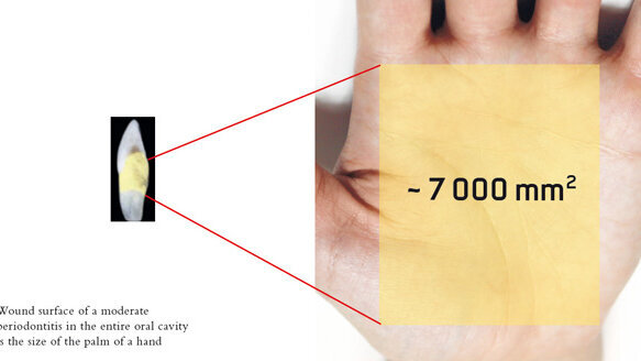 Air-Flow kills biofilm