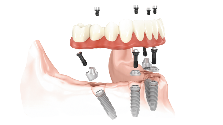 MALO CLINIC Protocol