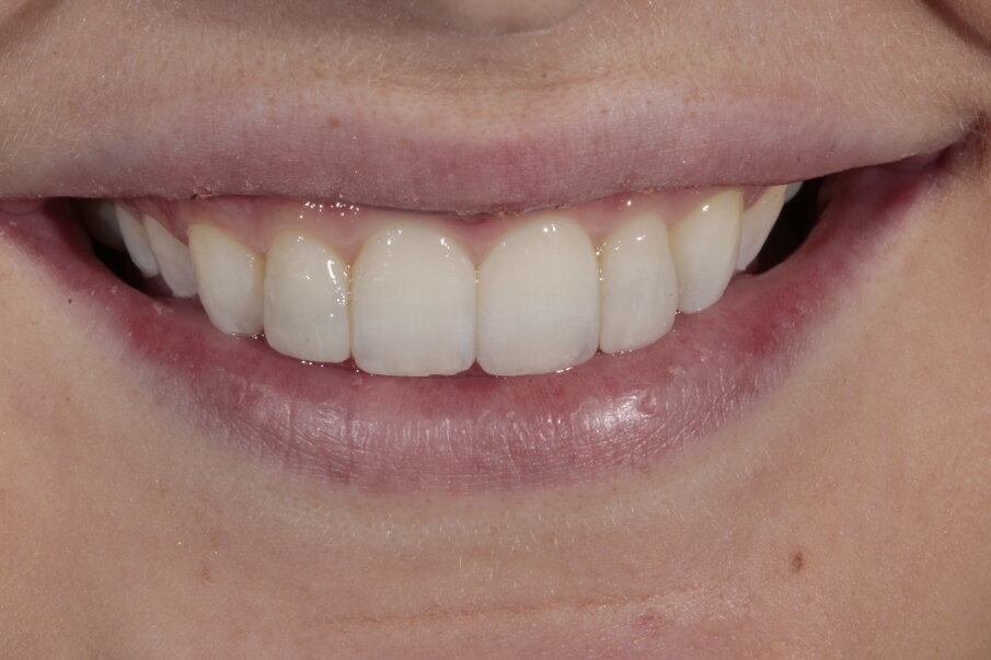 16. Eindsituatie, vooraanzicht