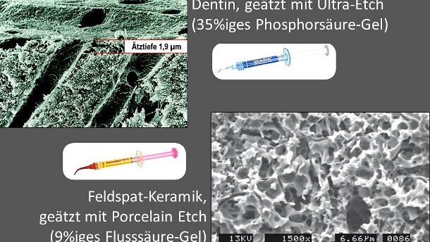 Online-Fortbildung: Zahnmediziner gibt Tipps zur Adhäsivtechnik