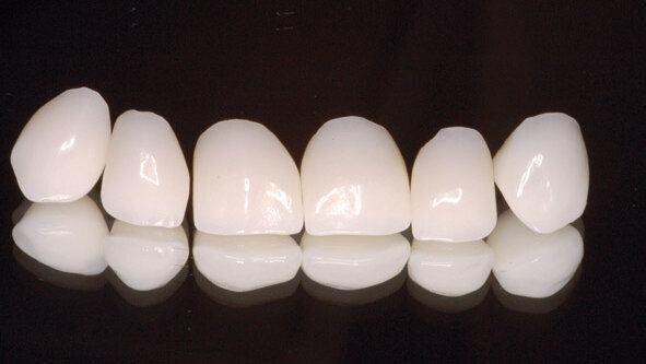 Co CAD/CAM zmienia w gabinecie