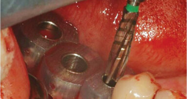 Misch Institute offering two of its most popular courses in one weekend