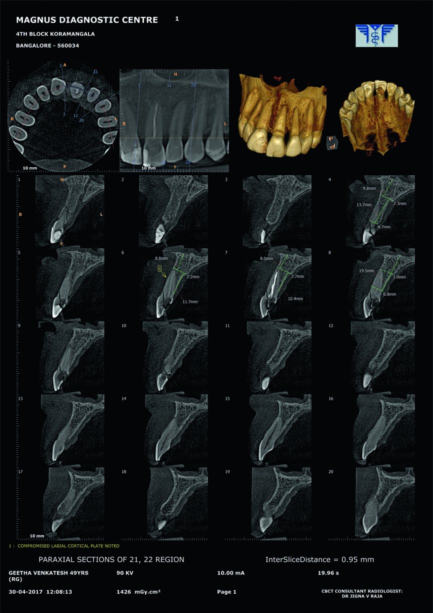 Fig. 1b : Examen CBCT. 