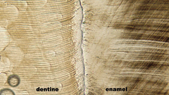 Molars provide insight into evolution of apes, humans