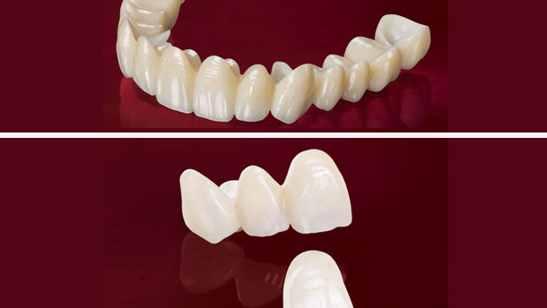 Los avanzados productos de zirconia de Glidewell ya están en Latinoamérica