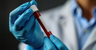 Kursreihe autologe Blutkonzentrate in der Zahnmedizin: Entnahme bis Anwendung