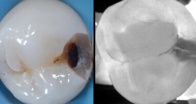 Primo Meeting Internazionale KaVo DIAGNOcam