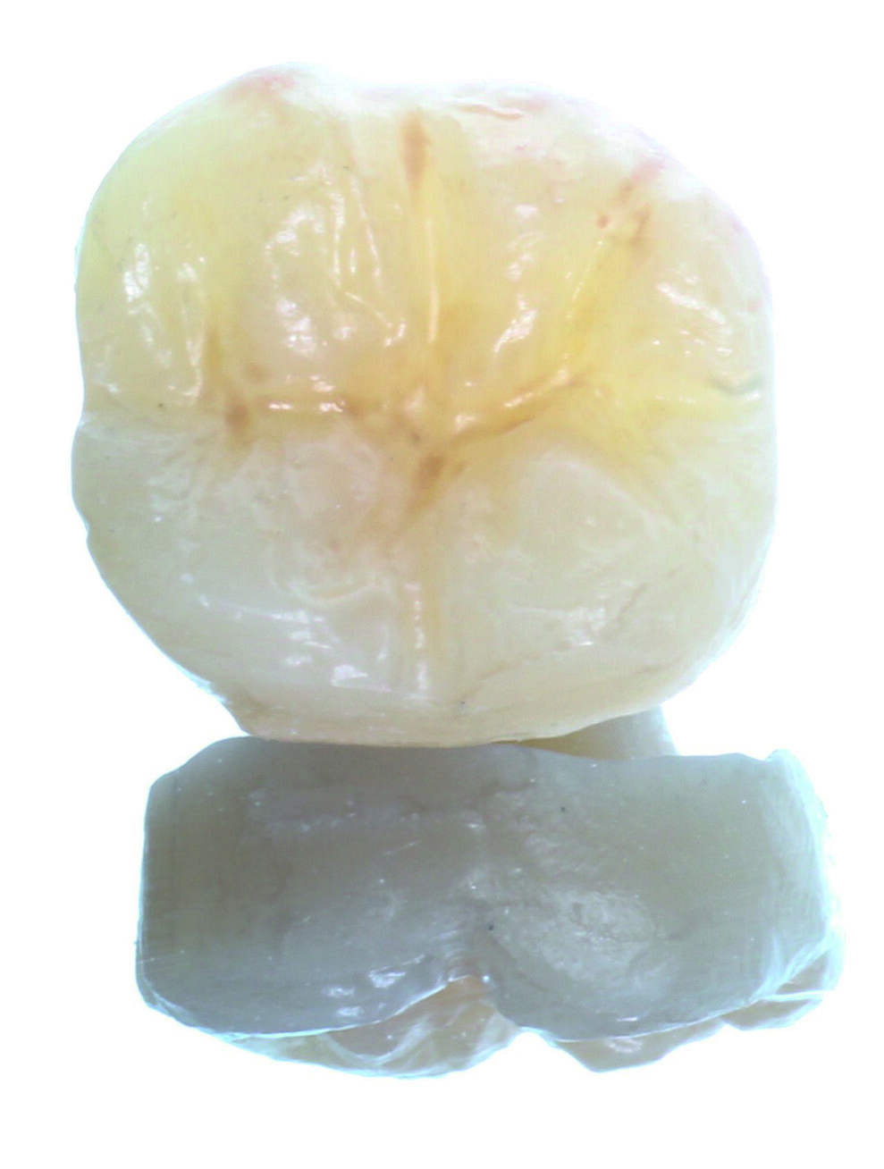 Fig. 11: Final endocrown after chromatic characterisation of the occlusal grooves and fissures with FinalTouch and subsequent polishing.