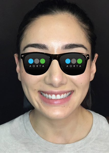 Fig. 9: Patient’s facial photograph after soft-tissue recontouring.