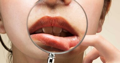 Update S2k-Leitlinie: Diagnostik und Therapieoptionen