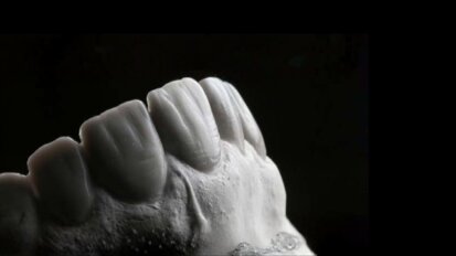 Redefining smile harmony: The concept of Hood Proportion for the  Malaysian population