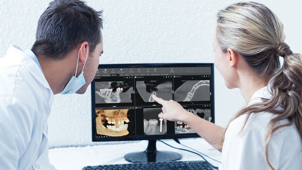 Dlaczego używanie CBCT w Twojej praktyce jest warte rozważenia