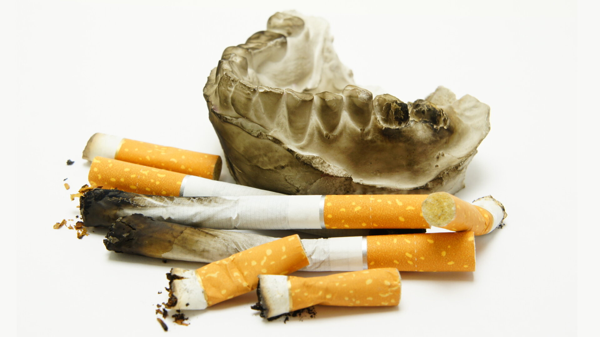 Redukcja szkód związanych z tytoniem, kluczowy element terapii periodontologicznej