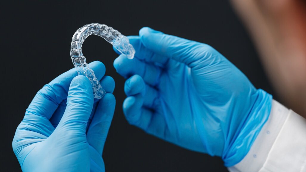 Allineatori stampati in 3D: uno studio evidenzia la necessità di protocolli di pulizia specifici per il materiale
