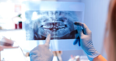 New VideaAI feature identifies aligner and implant candidates from radiographs