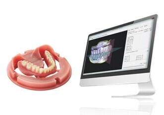 Baltic Denture System
