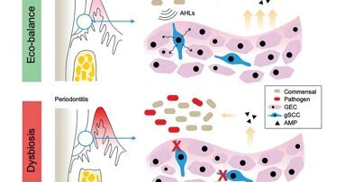 Identificirali so celice v dlesni, ki ščitijo pred parodontalno boleznijo