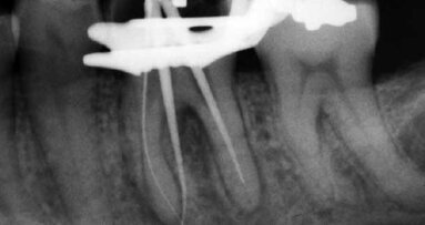 It’s never what you think it is