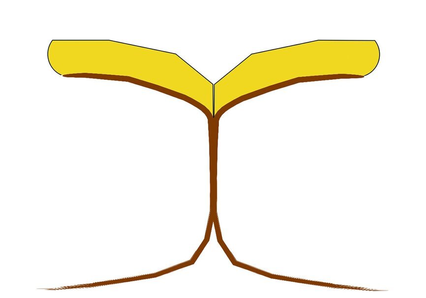Fig. 1: No-preparation veneer is adapt to the teeth with flat surface.