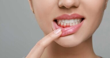 Mikronadelpflaster als neue Parodontitis-Behandlungsmethode?