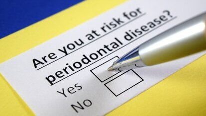 Ricercatori identificano sezioni del DNA responsabili della parodontite