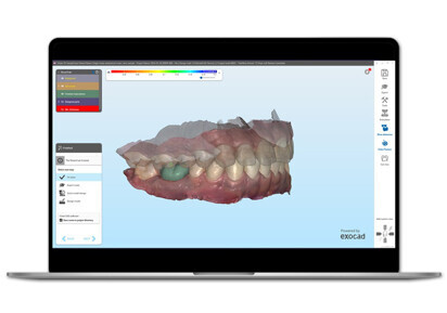 Align Technology – iTero Design Suite