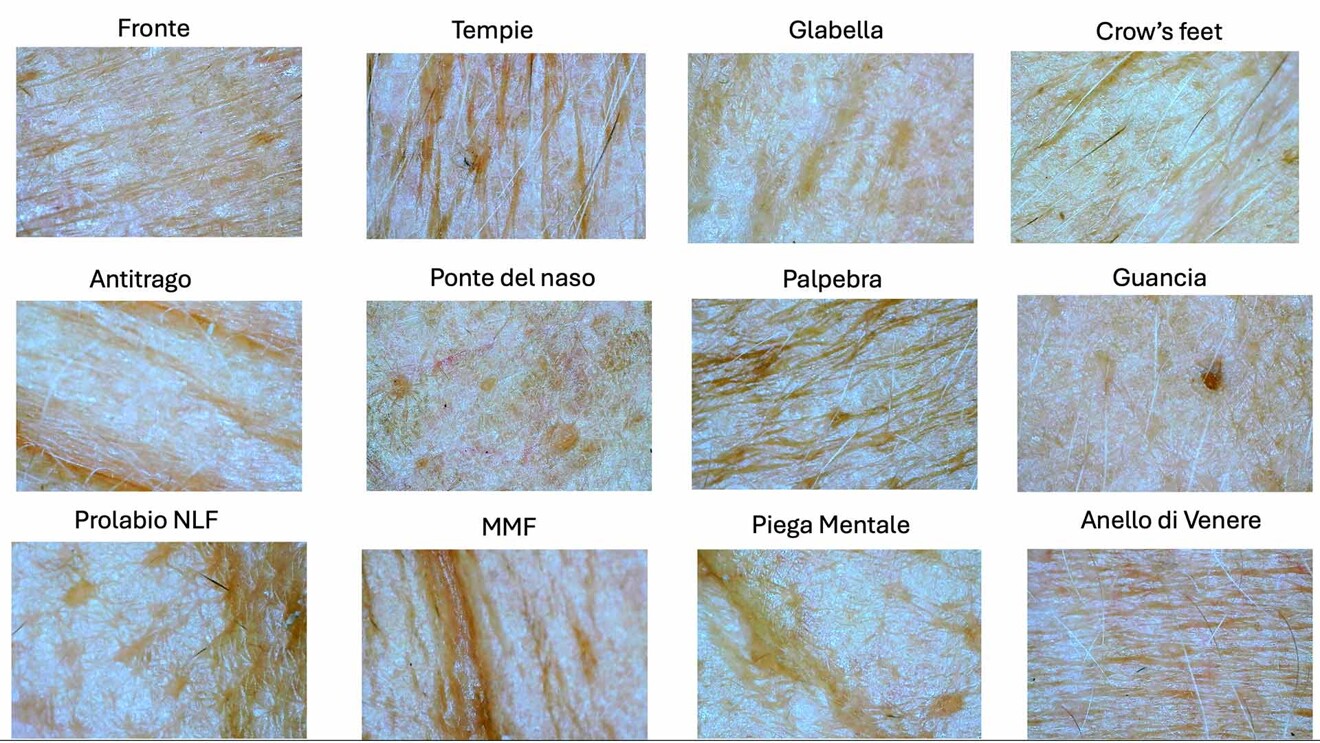Fig. 1 - L’aspetto esteriore della cute nei vari distretti del volto nel divenire dell’aging.