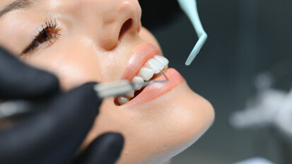 MiCD Fiber Filling: 4R protocol and applications