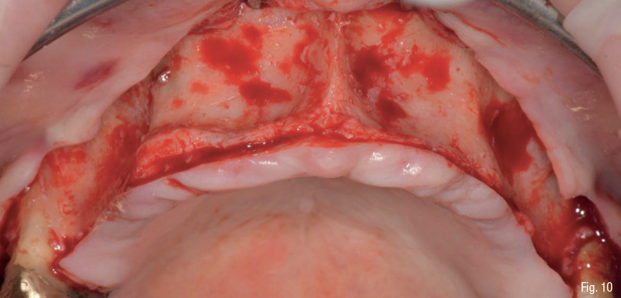 Fig. 10