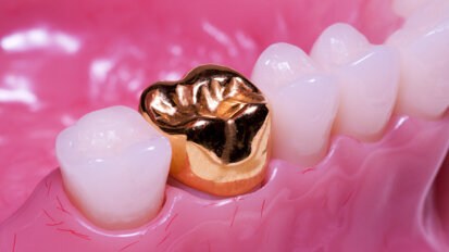 Dental entrepreneurs: Should you start your own DSO?