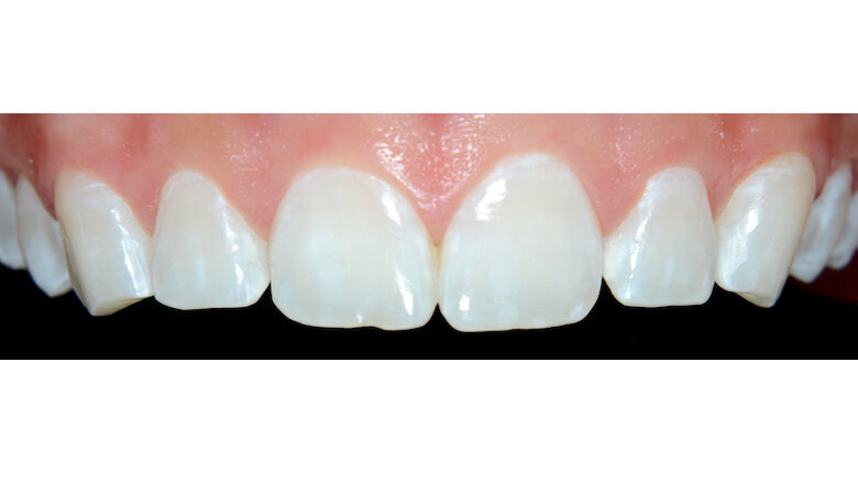 Foto 10. Sector antero superior después del tratamiento.
