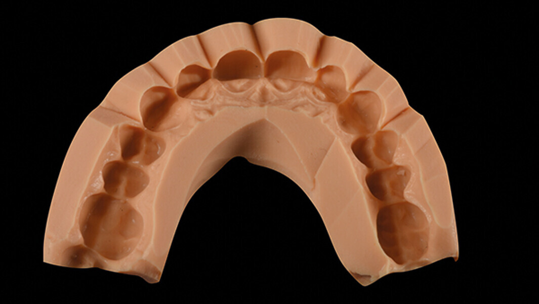 Fig. 8a. Mock-up de silicona.