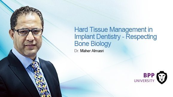 Live webinar: Administração do tecido duro em implante dentário