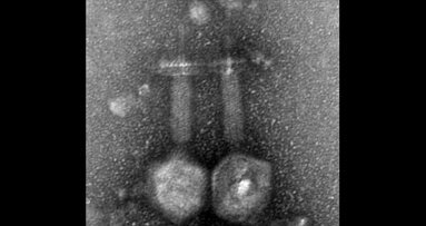 וירוס חיידקים הנמצא בשפכים של ירושלים יכול למנוע זיהומי תעלות שורש