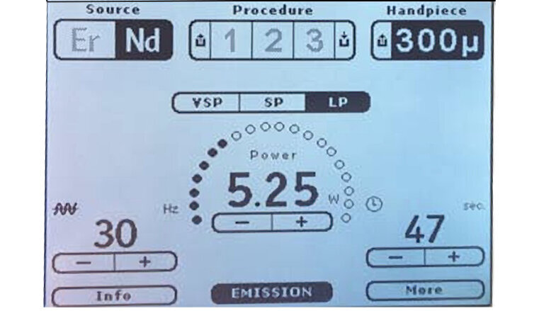 Fig. 2. Parámetros del láser para el tratamiento de fotocoagulación.