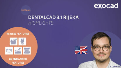 exocad – DentalCAD 3.1 Rijeka Highlights