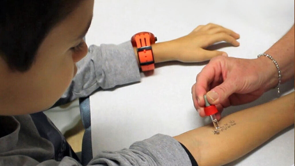 Allergie alimentari: farmaco per l’asma riduce il rischio di shock anafilattico