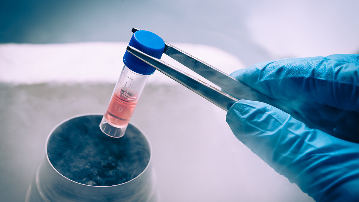 Stem cells from primary teeth may help repair adult teeth, study finds