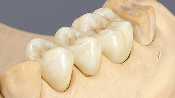 CAD/CAM, la tecnología que está revolucionando la industria dental (1)