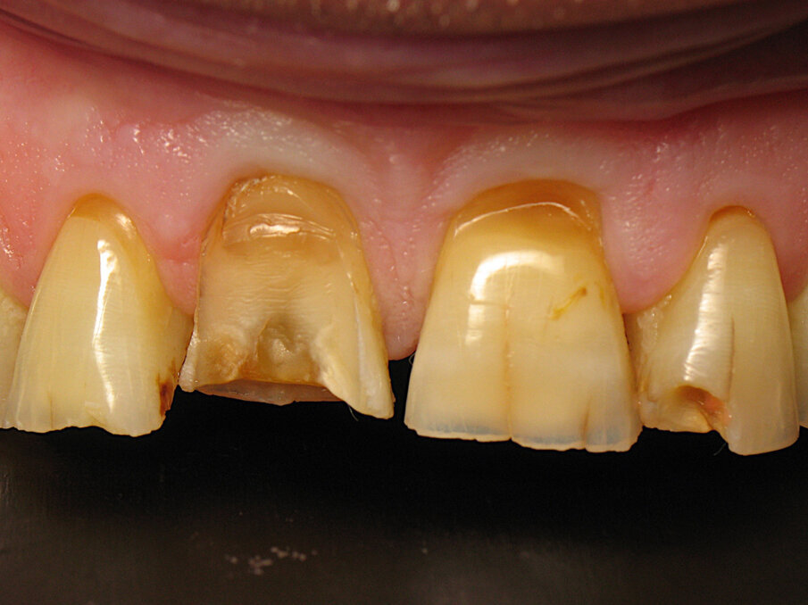 Fig. 12: Close-up of the initial situation.