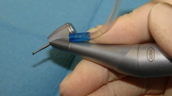 El primer contra-ángulo de 45 grados ofrece un acceso óptimo