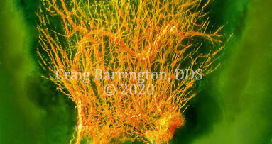 Advances in diaphanization and photography reveal wonders of dental pulp chamber